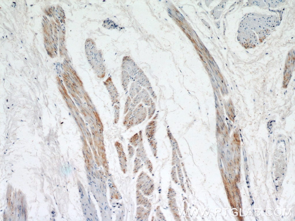 Immunohistochemistry (IHC) staining of human bladder tissue using MYH2-specific Polyclonal antibody (55069-1-AP)