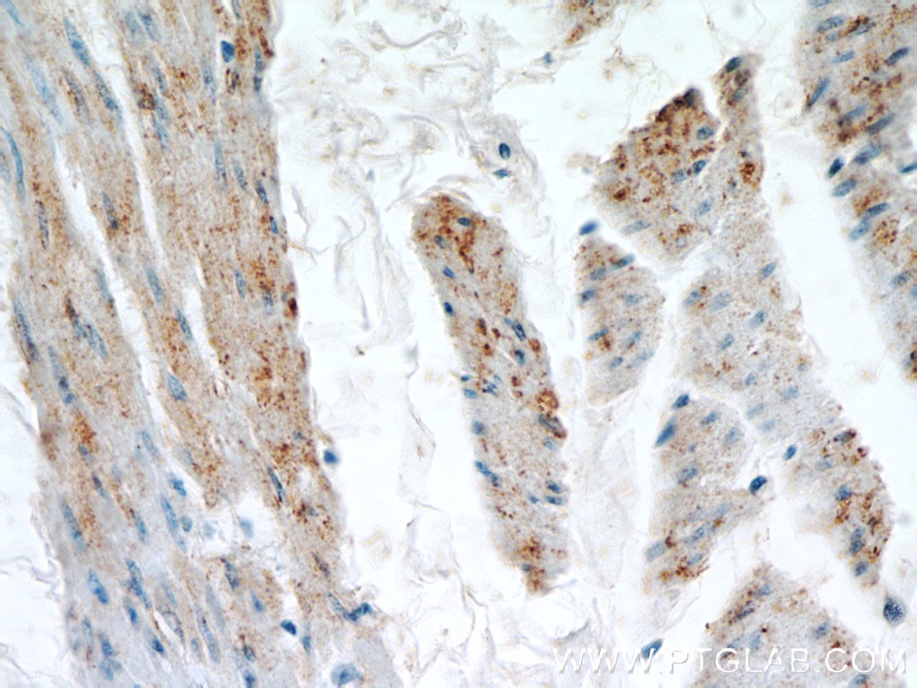 Immunohistochemistry (IHC) staining of human bladder tissue using MYH2-specific Polyclonal antibody (55069-1-AP)