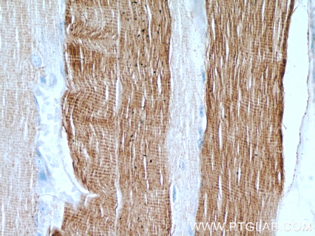 Immunohistochemistry (IHC) staining of human skeletal muscle tissue using MYH2-specific Polyclonal antibody (55069-1-AP)