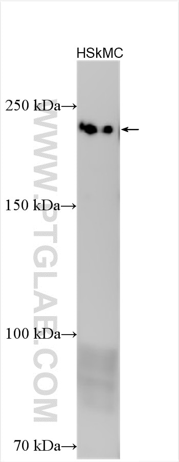 Western Blot (WB) analysis of various lysates using MYH2-specific Polyclonal antibody (55069-1-AP)