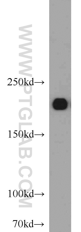 Western Blot (WB) analysis of human skeletal muscle tissue using MYH2-specific Polyclonal antibody (55069-1-AP)