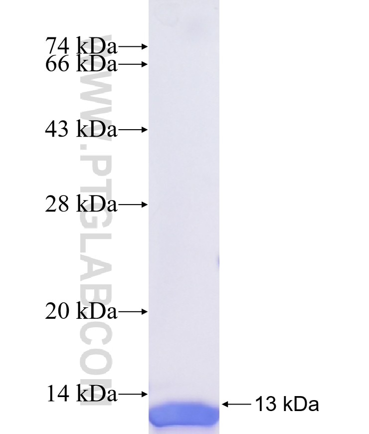 MYH2 fusion protein Ag40633 SDS-PAGE MYH2 fusion protein Ag40633 SDS-PAGE