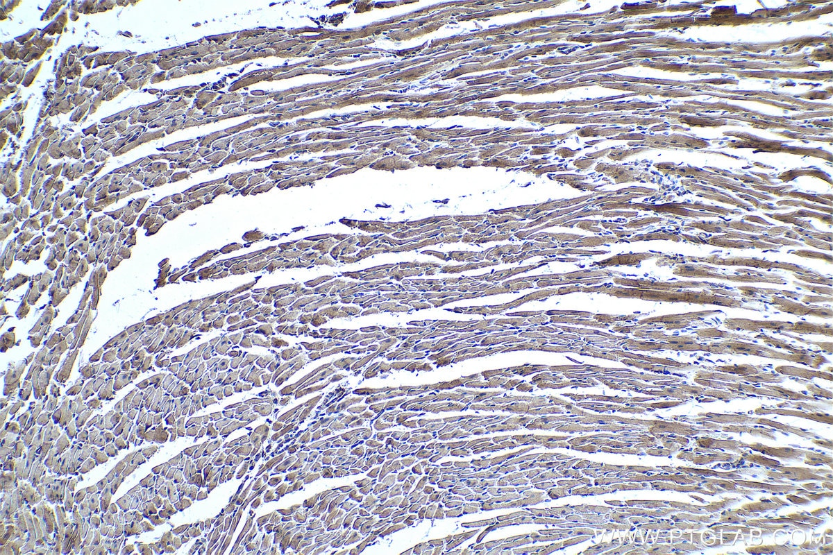 Immunohistochemistry (IHC) staining of mouse heart tissue using MYH3 Polyclonal antibody (22287-1-AP)