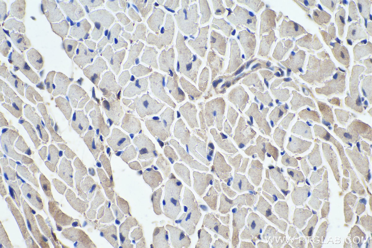 Immunohistochemistry (IHC) staining of mouse heart tissue using MYH3 Polyclonal antibody (22287-1-AP)