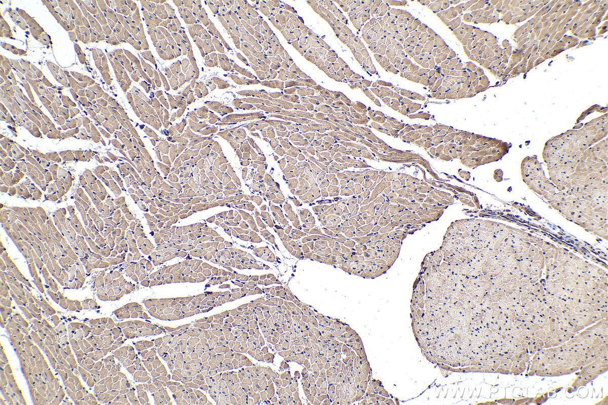 IHC staining of rat heart using 22287-1-AP