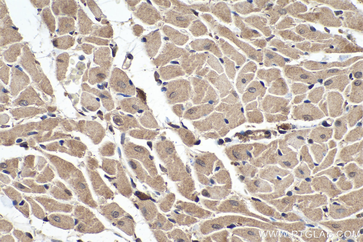 Immunohistochemistry (IHC) staining of rat heart tissue using MYH3 Polyclonal antibody (22287-1-AP)