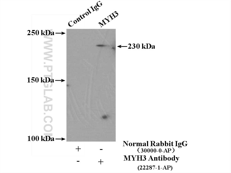 Immunoprecipitation (IP) experiment of mouse skeletal muscle tissue using MYH3 Polyclonal antibody (22287-1-AP)