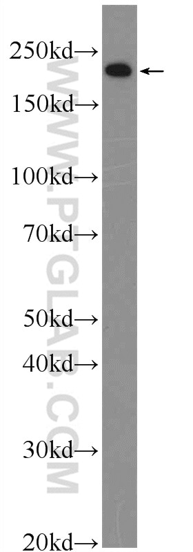 Western Blot (WB) analysis of mouse embryo tissue using MYH3 Polyclonal antibody (22287-1-AP)