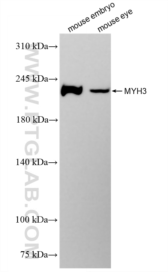 WB analysis using 85369-1-RR (same clone as 85369-1-PBS) Western Blot (WB) analysis of various lysates using MYH3 Recombinant monoclonal antibody (85369-1-RR)