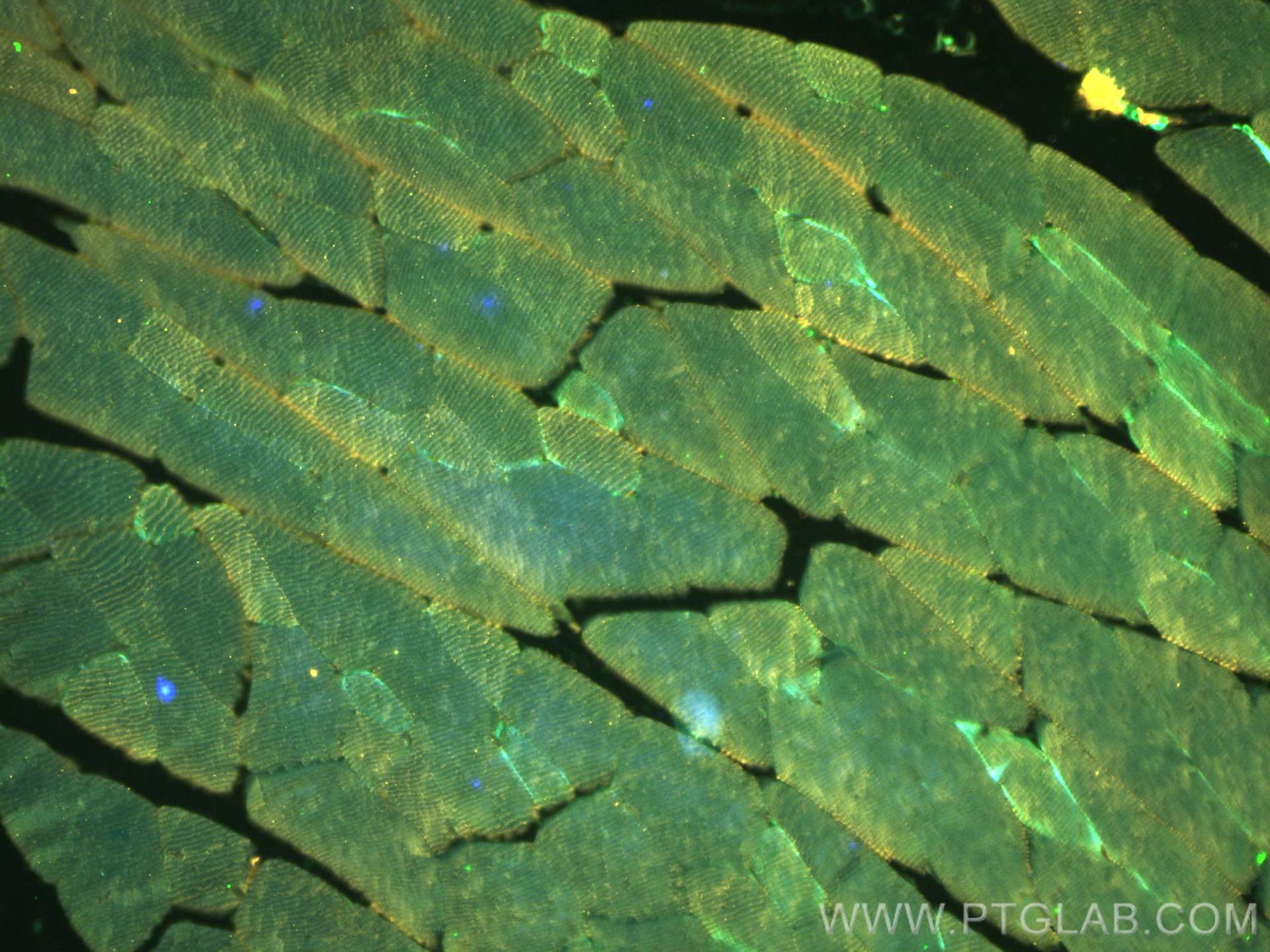 IF Staining of mouse skeletal muscle using 20140-1-AP