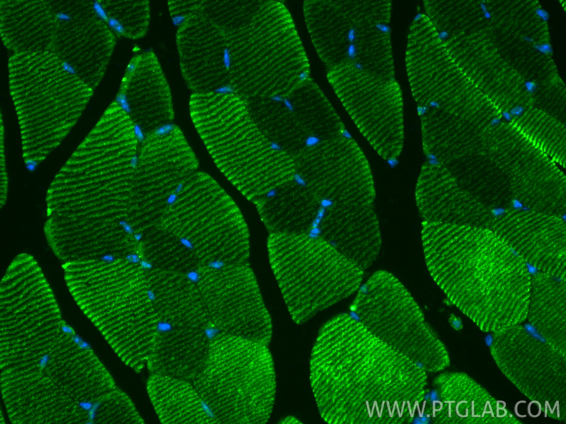 Immunofluorescence (IF) / fluorescent staining of mouse skeletal muscle tissue using MYH4-Specific Polyclonal antibody (20140-1-AP)