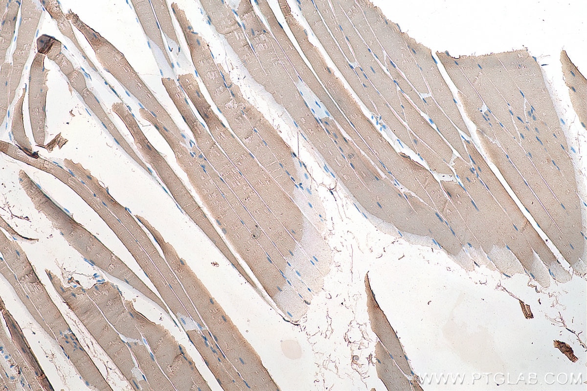 Immunohistochemistry (IHC) staining of mouse skeletal muscle tissue using MYH4-Specific Polyclonal antibody (20140-1-AP)