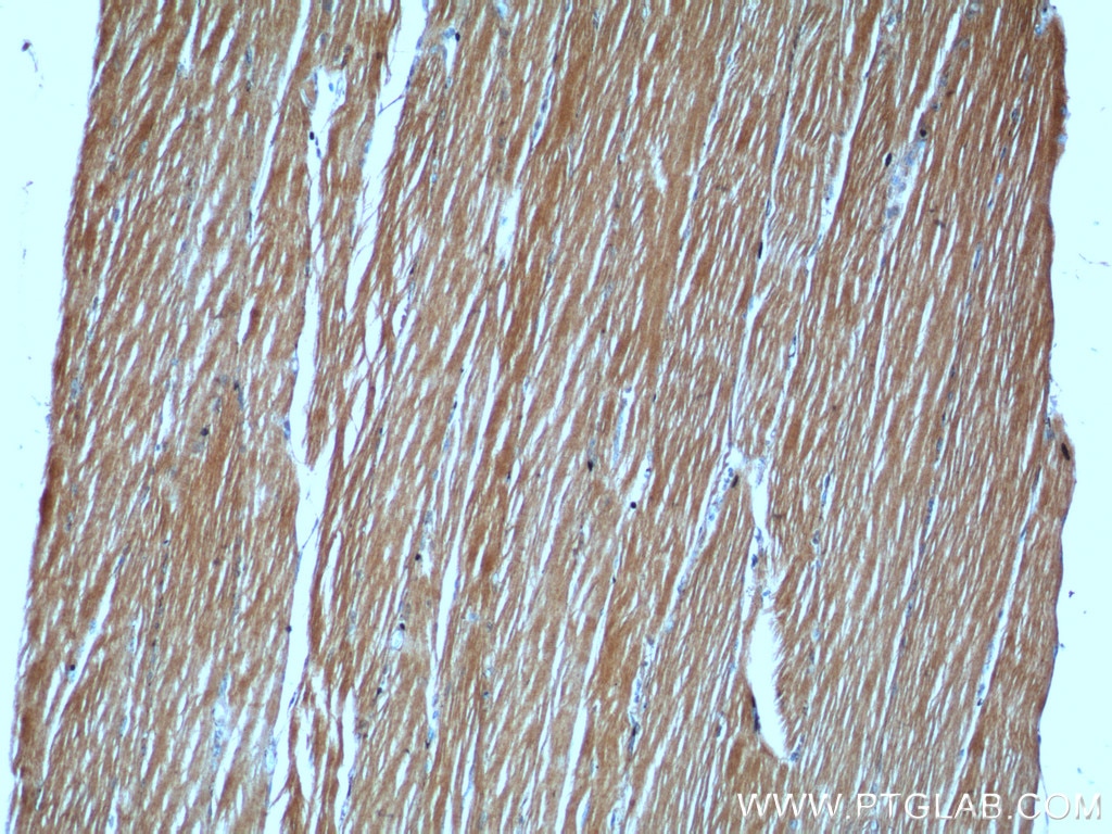 Immunohistochemistry (IHC) staining of human skeletal muscle tissue using MYH4-Specific Polyclonal antibody (20140-1-AP)