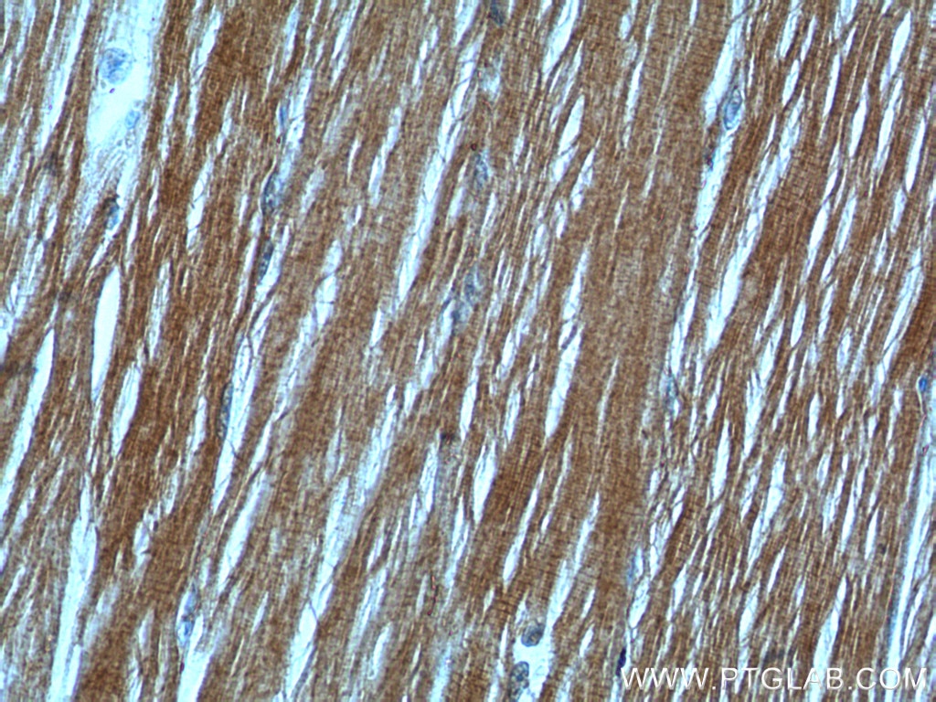 Immunohistochemistry (IHC) staining of human skeletal muscle tissue using MYH4-Specific Polyclonal antibody (20140-1-AP)