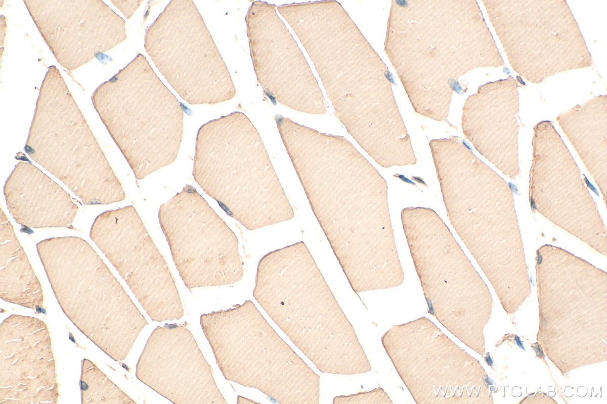 Immunohistochemistry (IHC) staining of mouse skeletal muscle tissue using MYH4-Specific Polyclonal antibody (20140-1-AP)