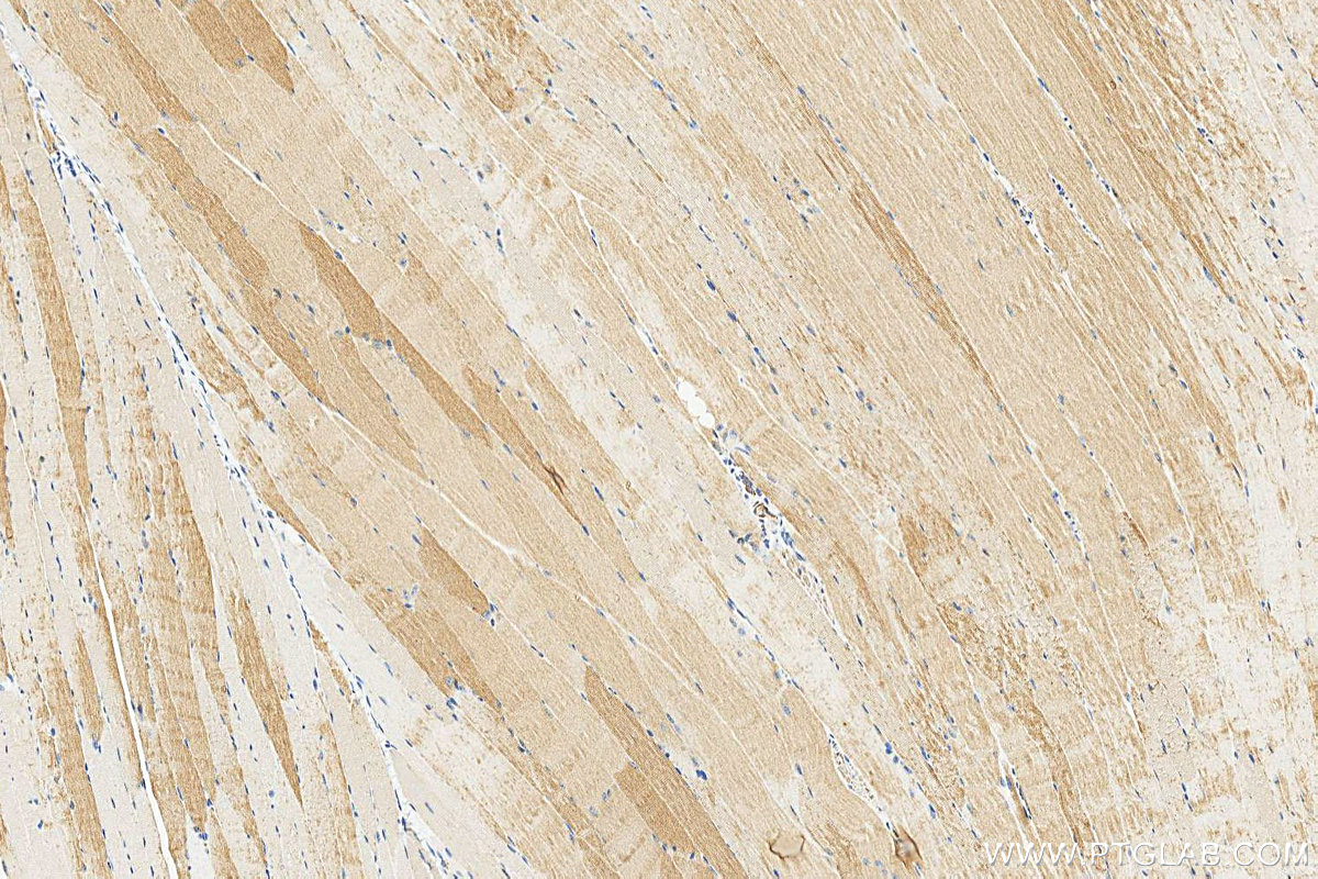 Immunohistochemistry (IHC) staining of mouse skeletal muscle tissue using MYH4-Specific Polyclonal antibody (20140-1-AP)