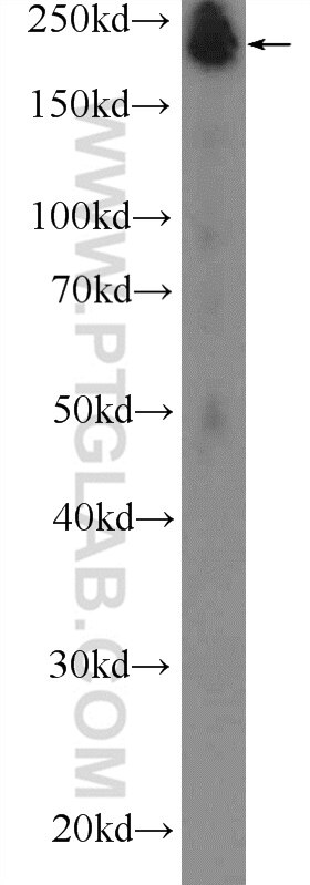 Western Blot (WB) analysis of human skeletal muscle tissue using MYH4-Specific Polyclonal antibody (20140-1-AP)