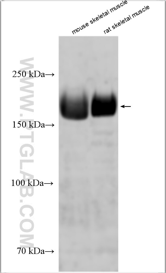 Western Blot (WB) analysis of various lysates using MYH4-Specific Polyclonal antibody (20140-1-AP)