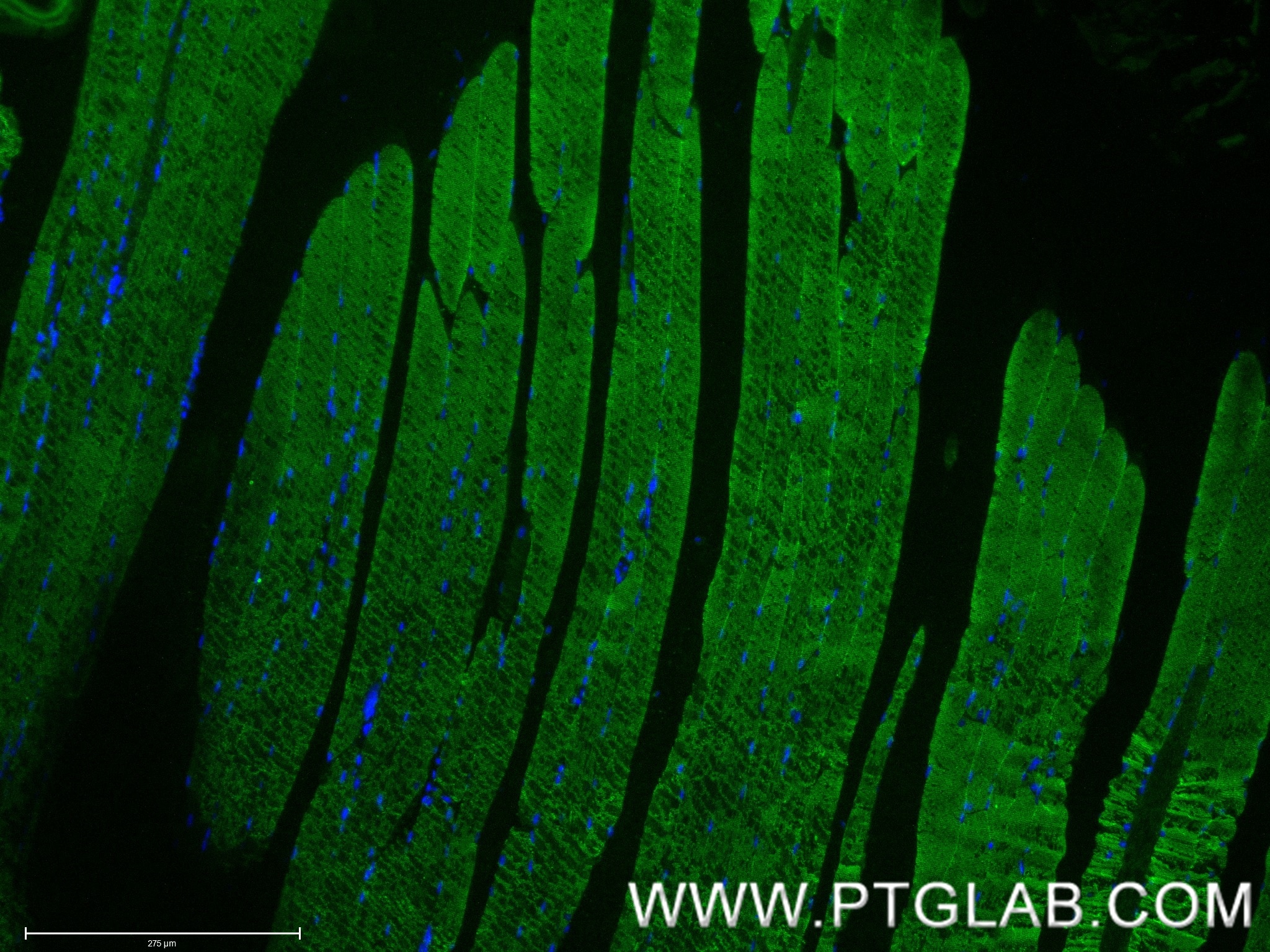 Immunofluorescent analysis of (4% PFA) fixed paraffin-embedded mouse skeletal muscle tissue using MYH4-Specific antibody (85376-1-RR, Clone: 242795B2 ) at dilution of 1:400 and CoraLite®488-Conjugated Goat Anti-Rabbit IgG(H+L) (SA00013-2). Heat mediated antigen retrieval with Tris-EDTA buffer (pH 9.0). Immunofluorescence (IF) / fluorescent staining of mouse skeletal muscle tissue using MYH4-Specific Recombinant monoclonal antibody (85376-1-RR)
