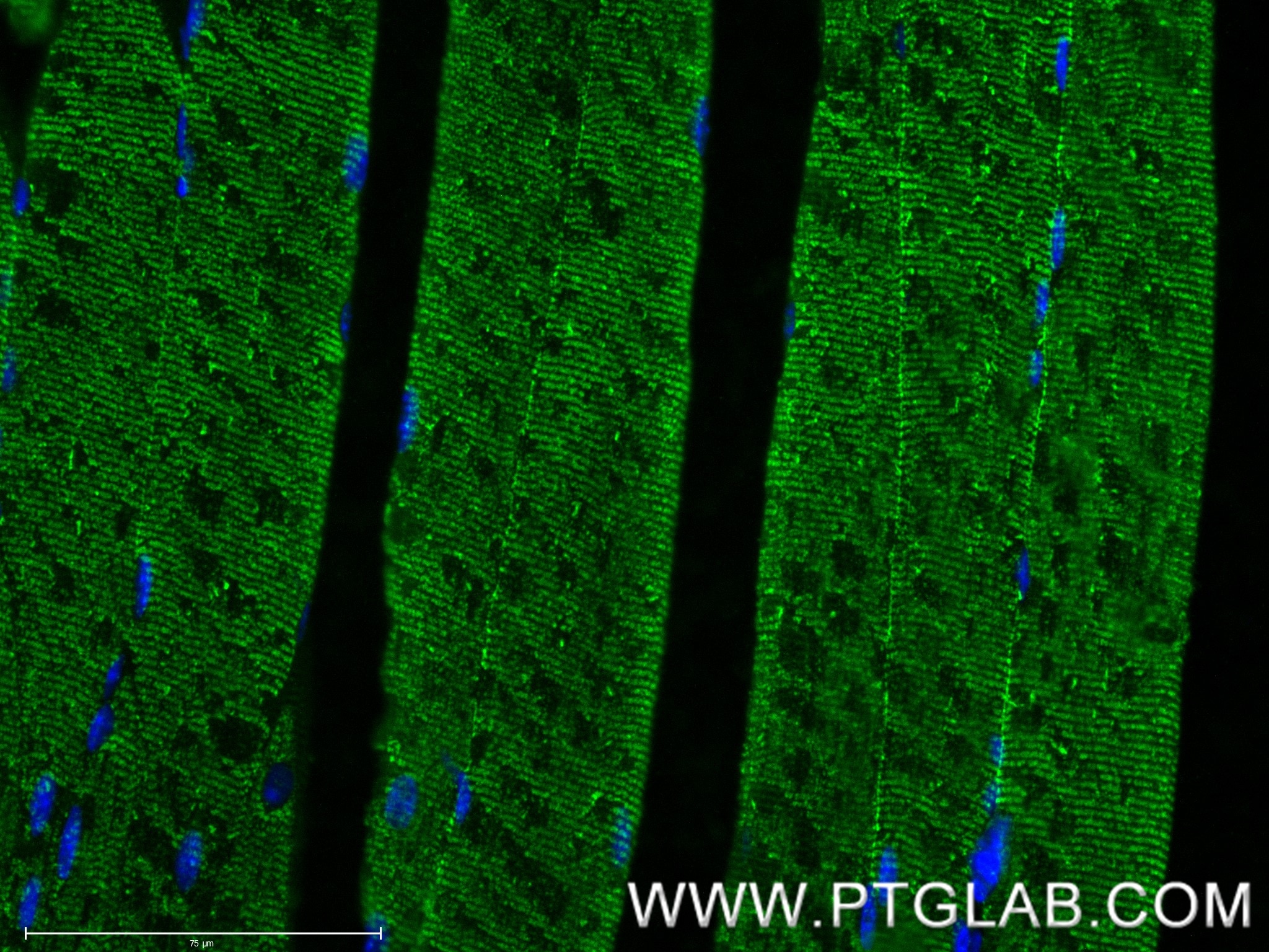 Immunofluorescent analysis of (4% PFA) fixed paraffin-embedded mouse skeletal muscle tissue using MYH4-Specific antibody (85376-1-RR, Clone: 242795B2 ) at dilution of 1:400 and CoraLite®488-Conjugated Goat Anti-Rabbit IgG(H+L) (SA00013-2). Heat mediated antigen retrieval with Tris-EDTA buffer (pH 9.0). Immunofluorescence (IF) / fluorescent staining of mouse skeletal muscle tissue using MYH4-Specific Recombinant monoclonal antibody (85376-1-RR)