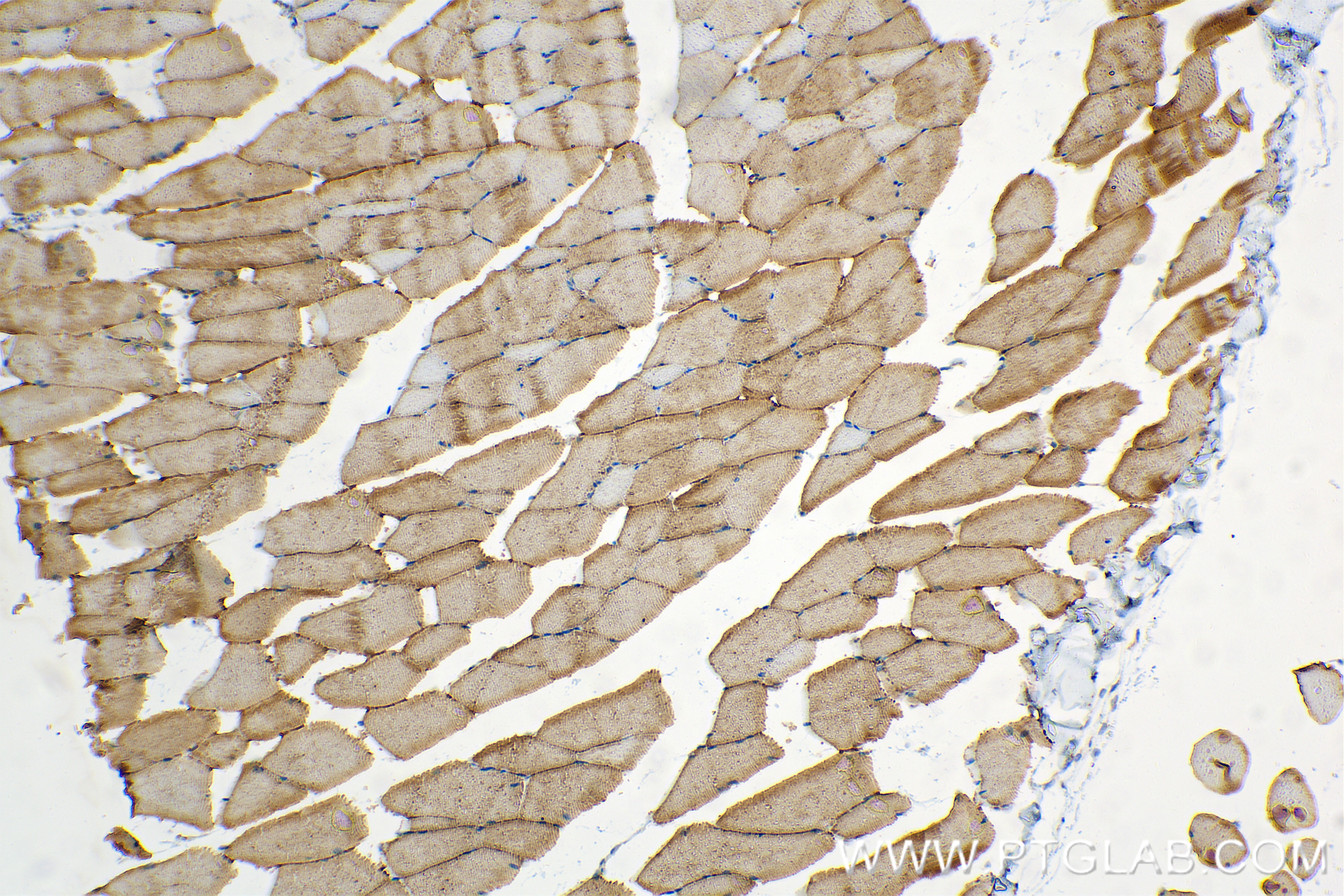 Immunohistochemistry (IHC) staining of mouse skeletal muscle tissue using MYH4-Specific Recombinant antibody (85376-1-RR)
