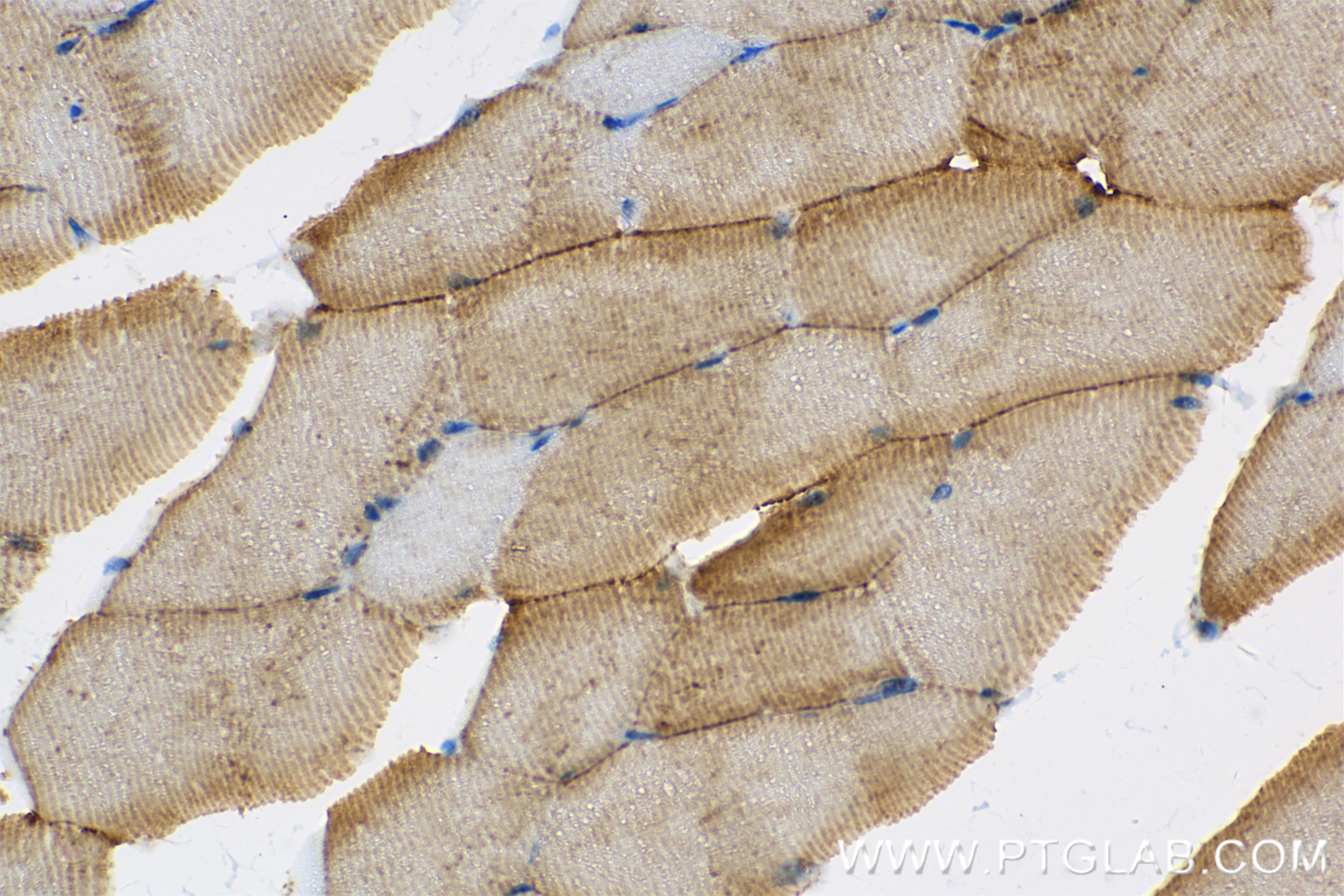 Immunohistochemistry (IHC) staining of mouse skeletal muscle tissue using MYH4-Specific Recombinant antibody (85376-1-RR)