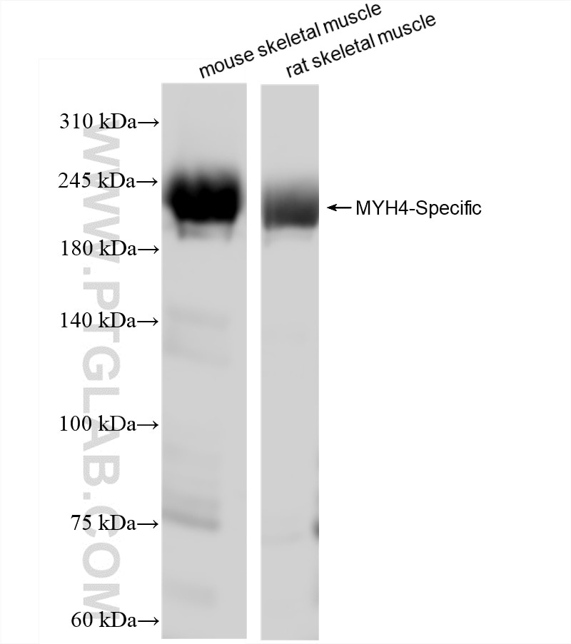 Western Blot (WB) analysis of various lysates using MYH4-Specific Recombinant antibody (85376-1-RR)