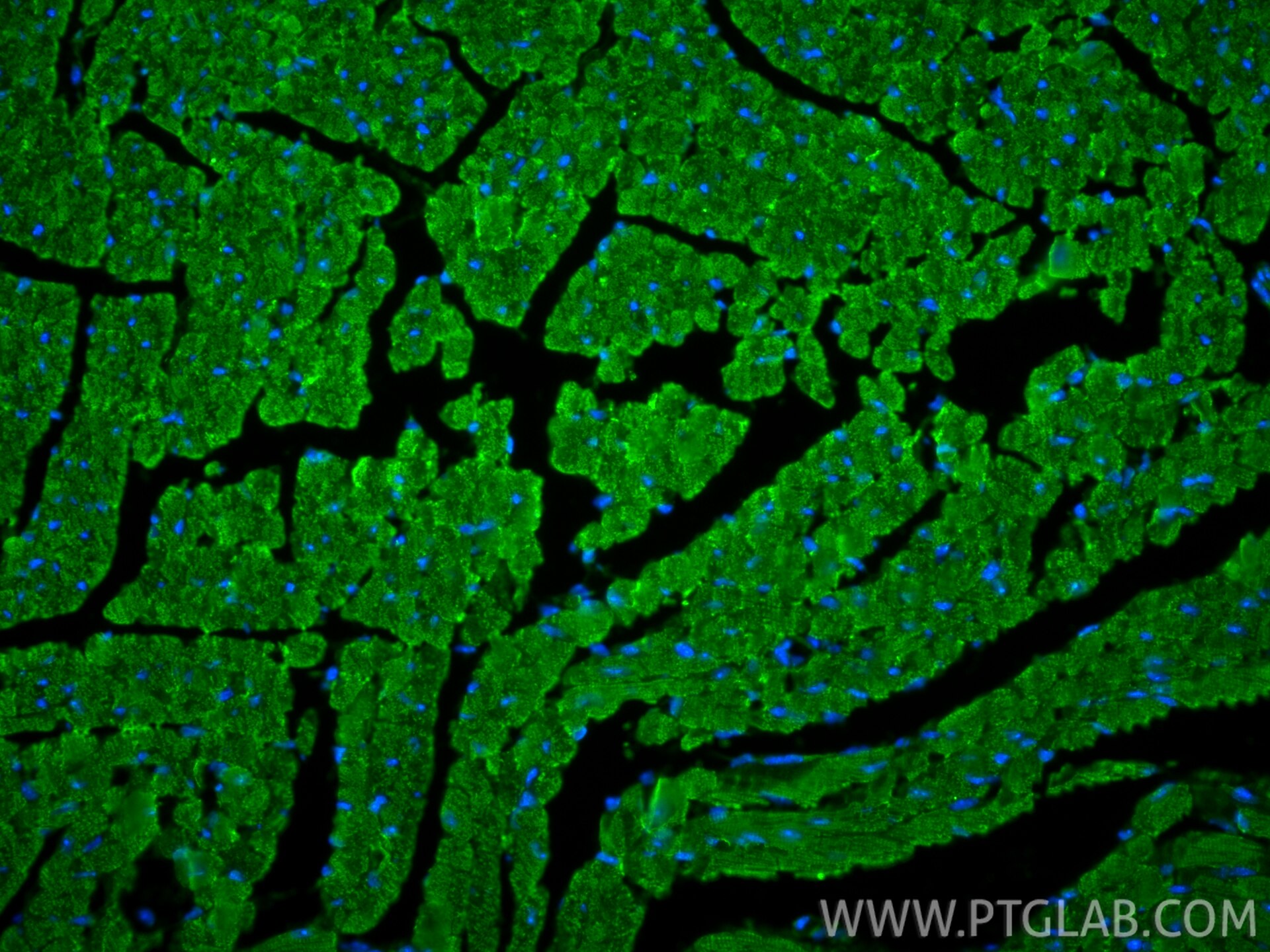Immunofluorescence (IF) / fluorescent staining of mouse heart tissue using MYH6 Polyclonal antibody (22281-1-AP)