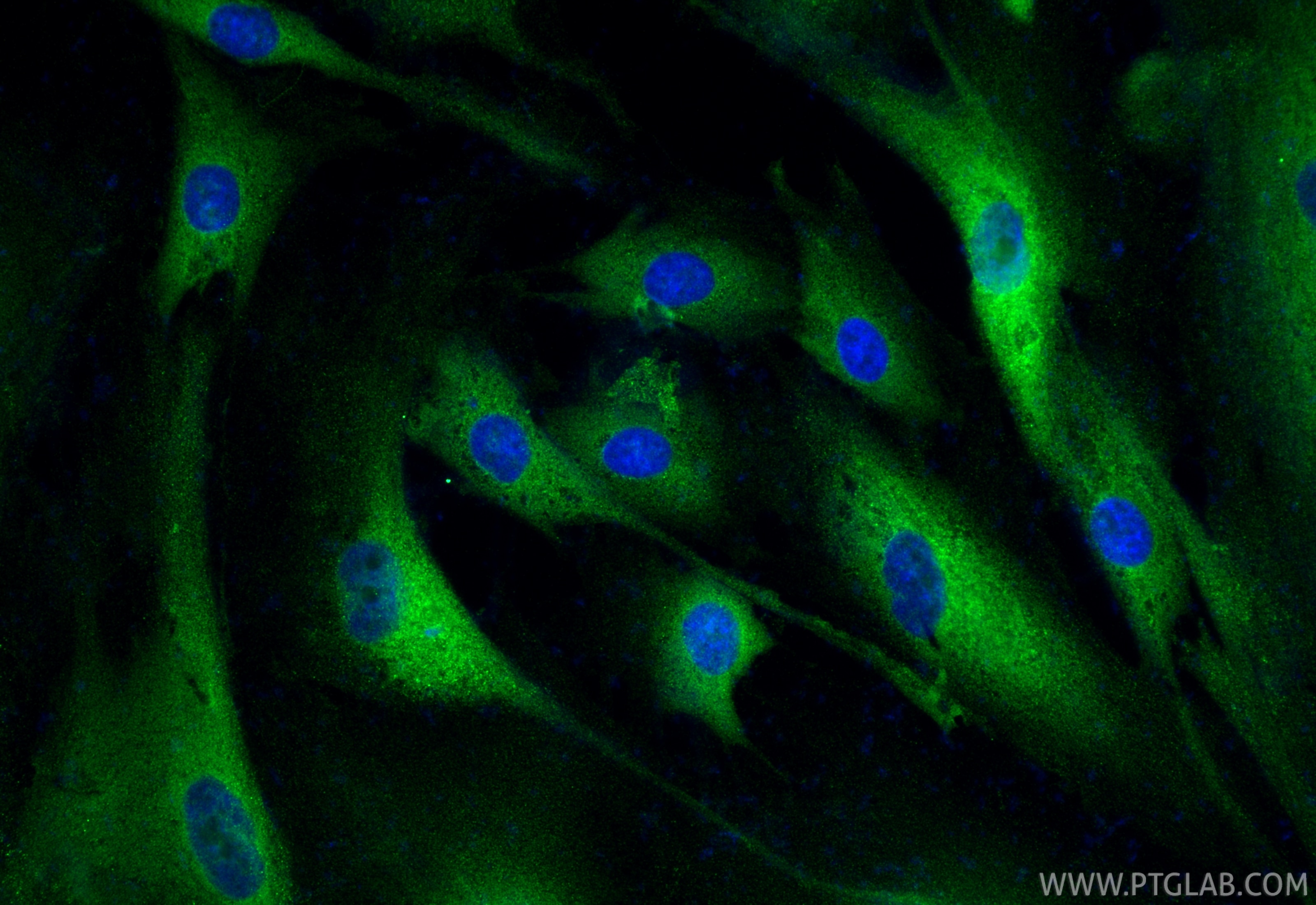 Immunofluorescence (IF) / fluorescent staining of HSkMC cells using MYH6 Polyclonal antibody (22281-1-AP)