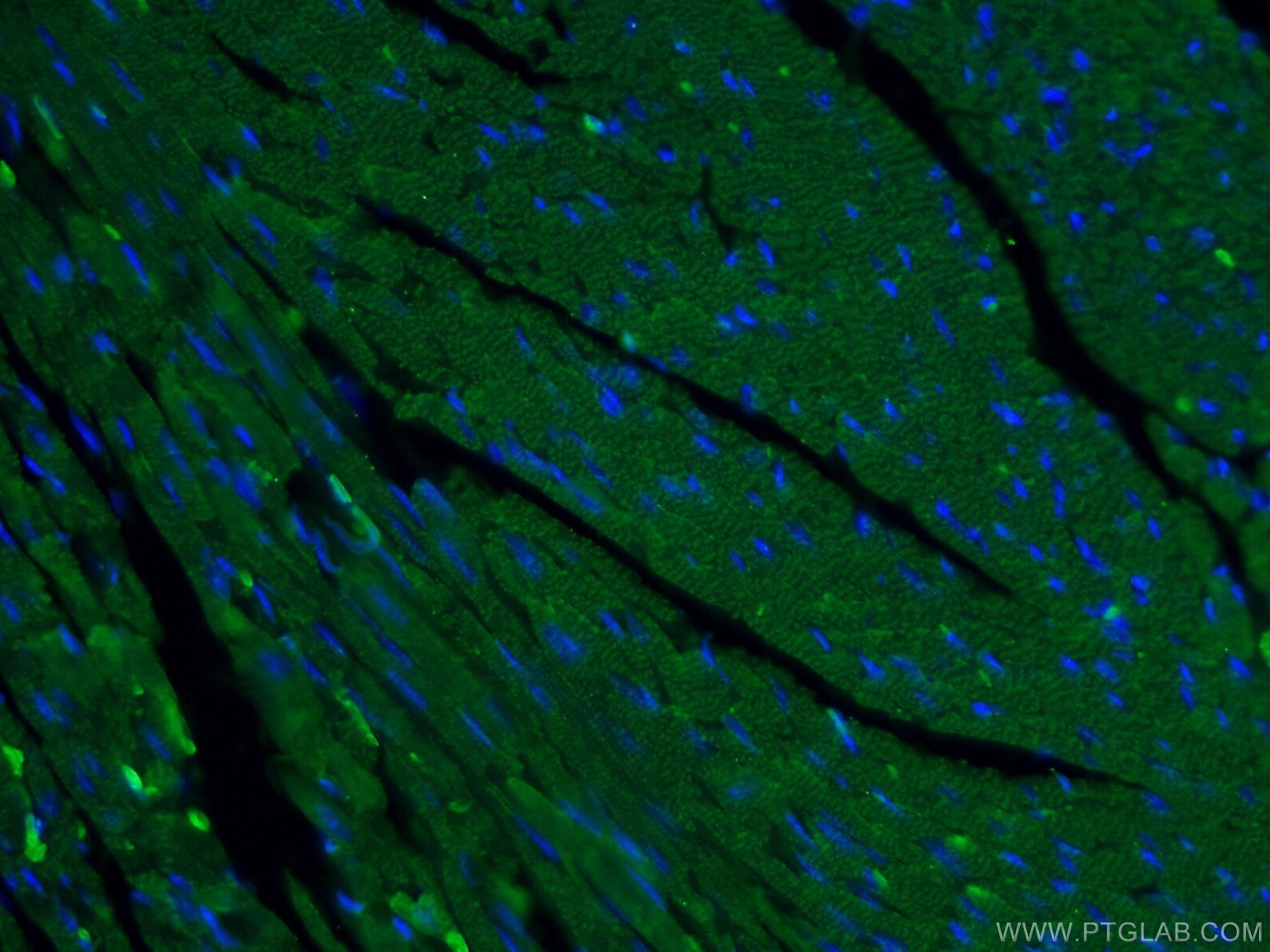Immunofluorescence (IF) / fluorescent staining of mouse heart tissue using MYH6 Polyclonal antibody (22281-1-AP)