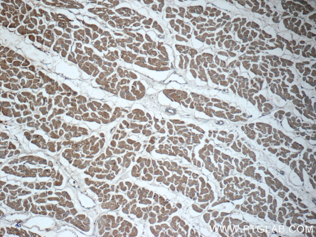 Immunohistochemistry (IHC) staining of human heart tissue using MYH6 Polyclonal antibody (22281-1-AP)