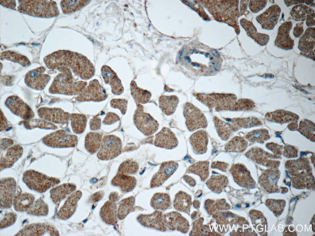 Immunohistochemistry (IHC) staining of human heart tissue using MYH6 Polyclonal antibody (22281-1-AP)