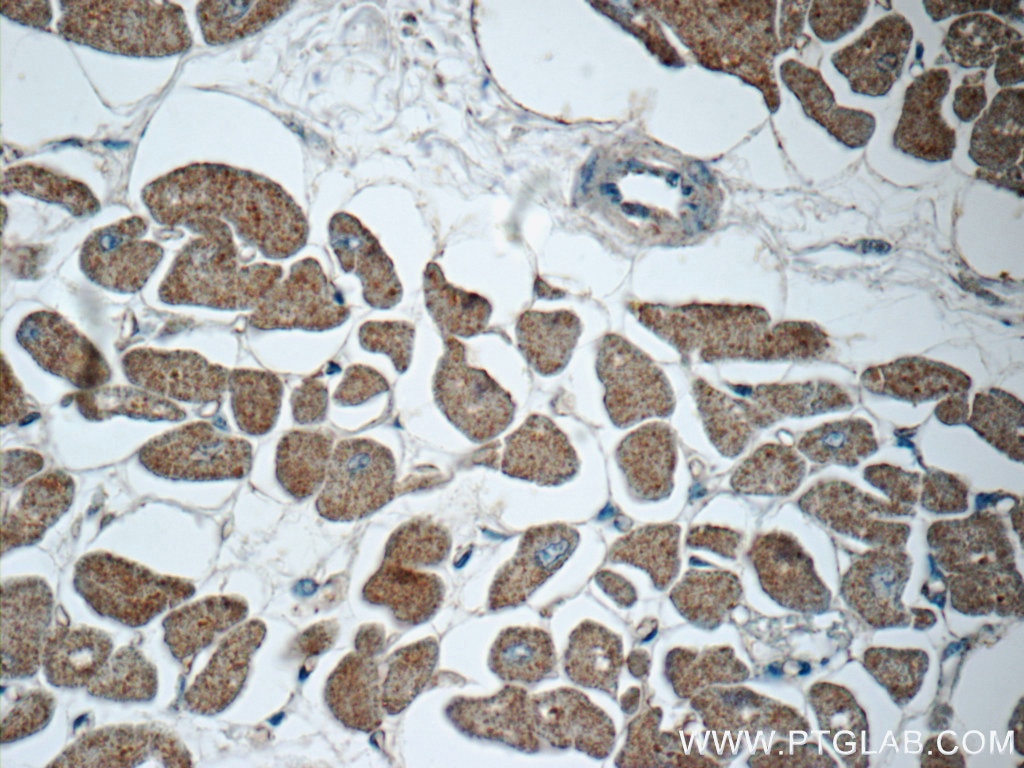 MYH6 Polyclonal antibody