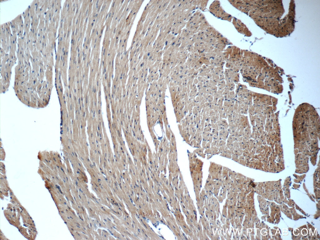 Immunohistochemistry (IHC) staining of mouse heart tissue using MYH6 Polyclonal antibody (22281-1-AP)