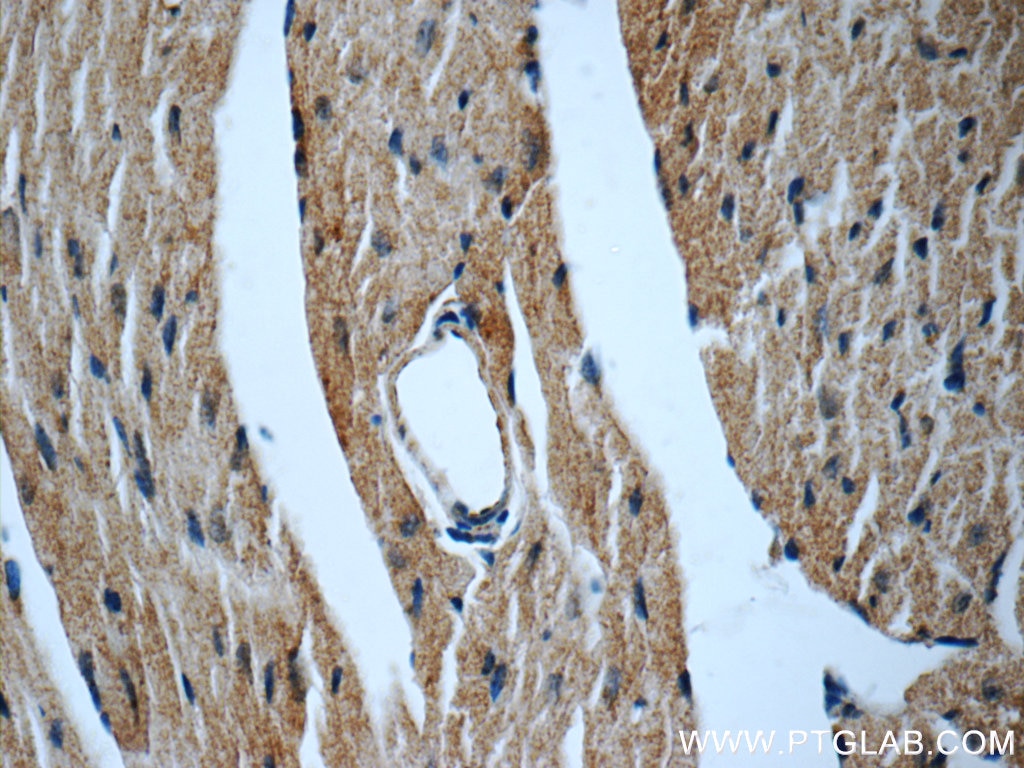 IHC staining of mouse heart using 22281-1-AP