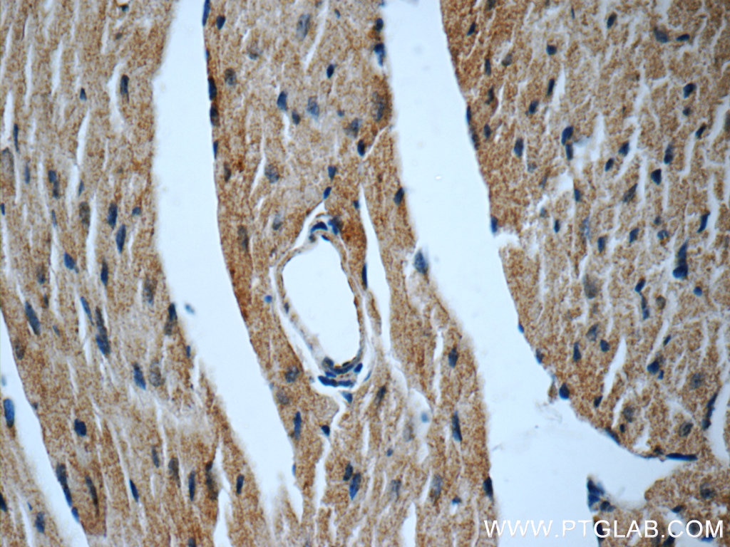 Immunohistochemistry (IHC) staining of mouse heart tissue using MYH6 Polyclonal antibody (22281-1-AP)