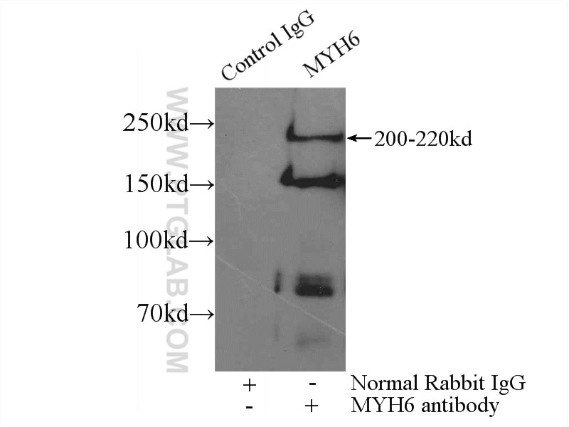 Immunoprecipitation (IP) experiment of mouse heart tissue using MYH6 Polyclonal antibody (22281-1-AP)