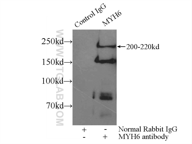 IP experiment of mouse heart using 22281-1-AP