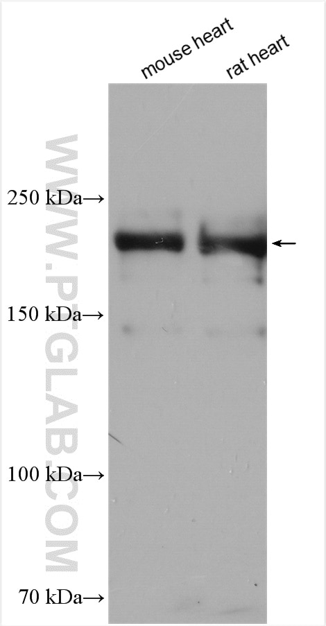 Western Blot (WB) analysis of various lysates using MYH6 Polyclonal antibody (22281-1-AP)