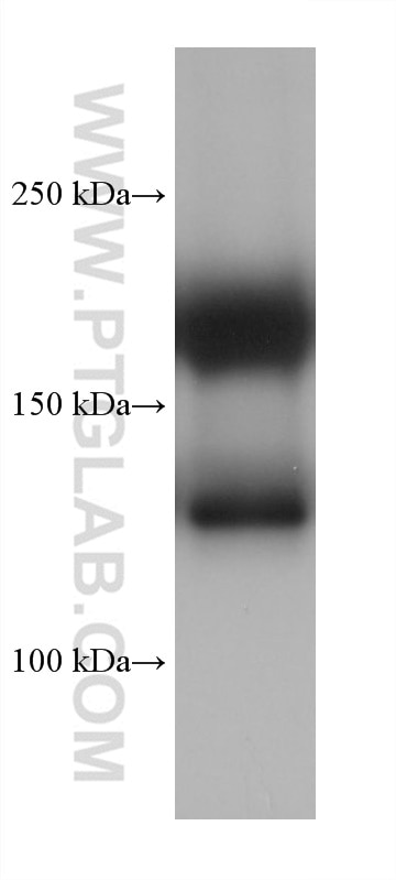 Western Blot (WB) analysis of rat heart tissue using MYH6 Monoclonal antibody (68461-1-Ig)