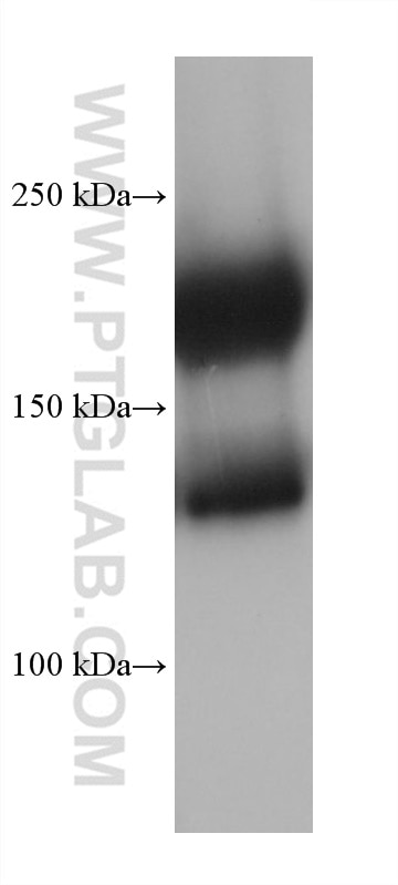 Western Blot (WB) analysis of mouse heart tissue using MYH6 Monoclonal antibody (68461-1-Ig)