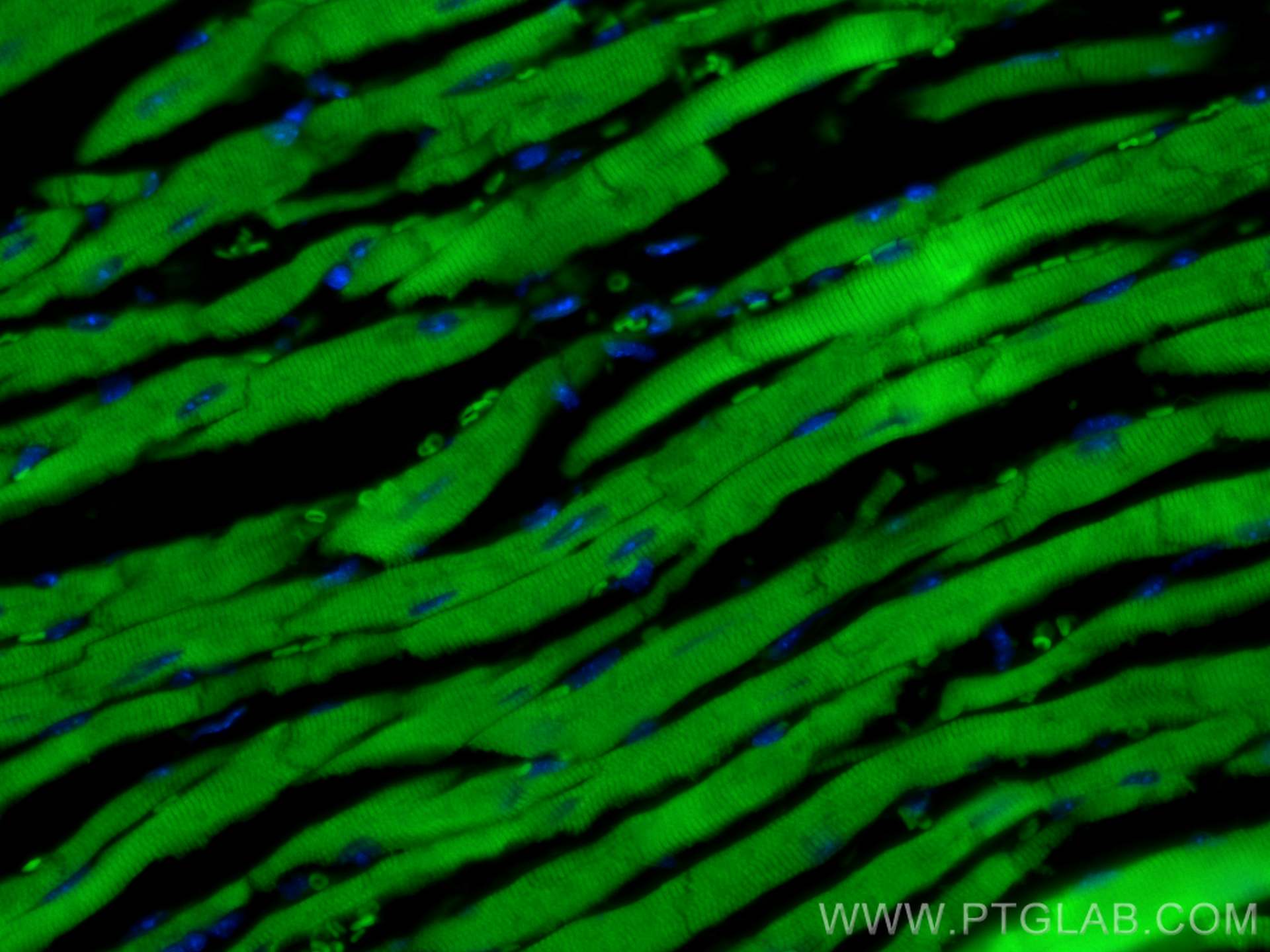 Immunofluorescence (IF) / fluorescent staining of mouse heart tissue using CoraLite® Plus 488-conjugated MYH6 Polyclonal anti (CL488-22281)