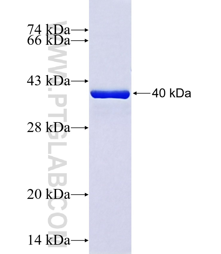 MYH6 fusion protein Ag40981 SDS-PAGE MYH6 fusion protein Ag40981 SDS-PAGE