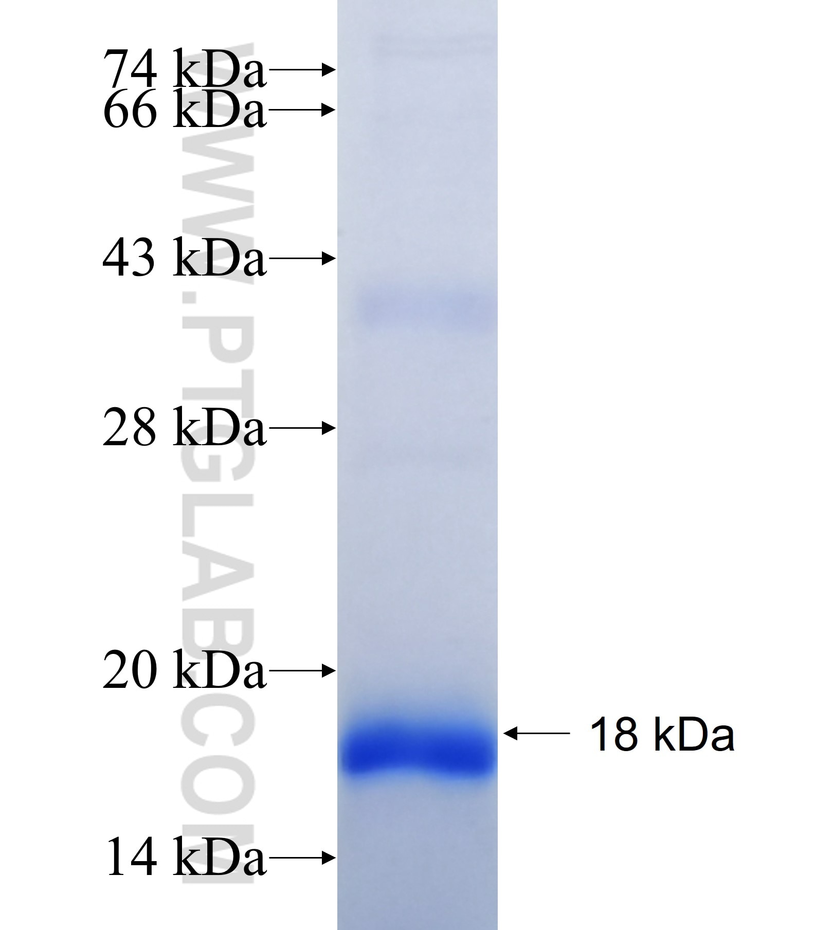 MYH6 fusion protein Ag41028 SDS-PAGE