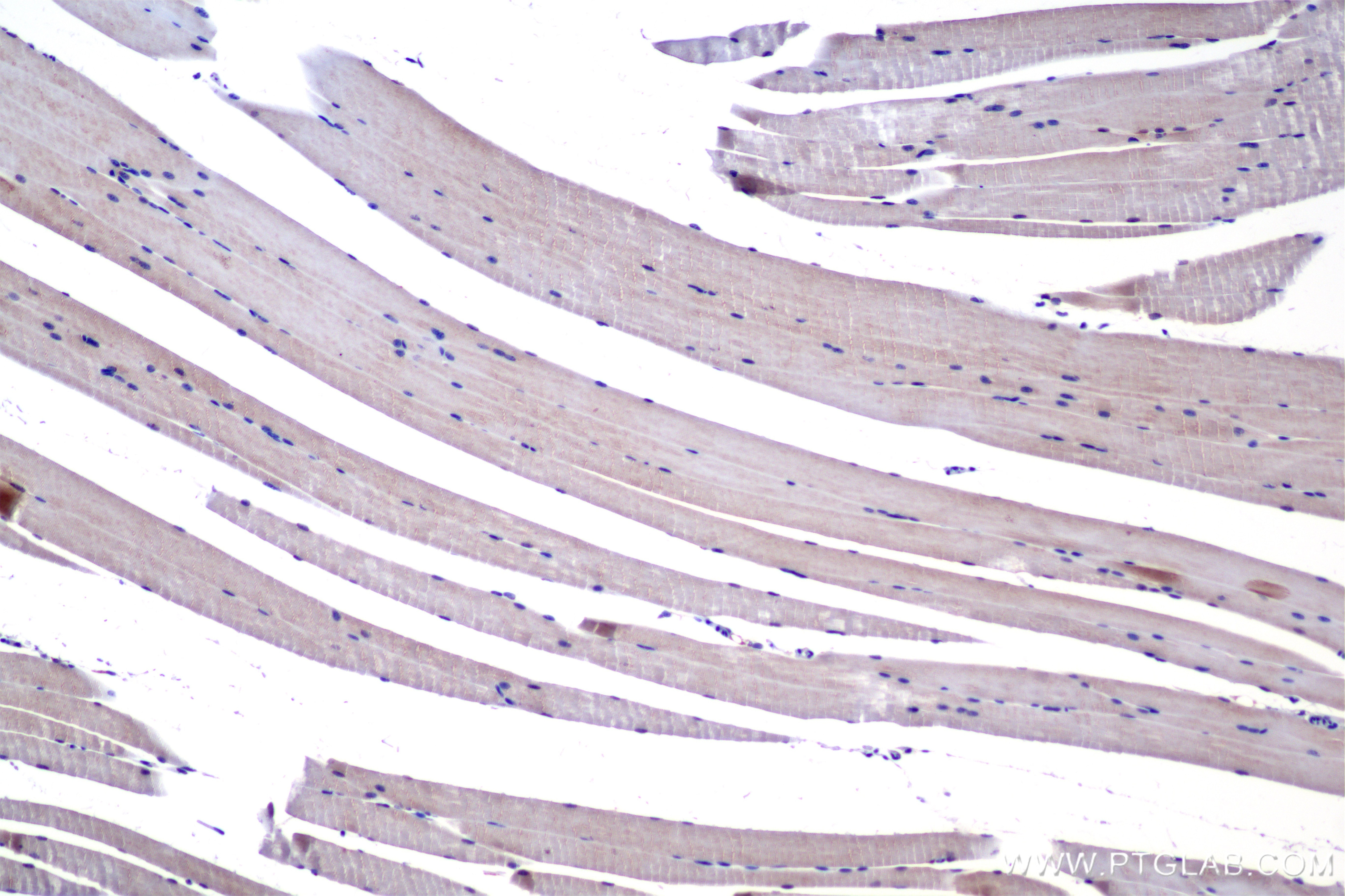 Immunohistochemical analysis of paraffin-embedded mouse skeletal muscle tissue slide using 85322-1-RR (MYH7 antibody) at dilution of 1:800 (under 10x lens). Heat mediated antigen retrieval with Tris-EDTA buffer (pH 9.0). Immunohistochemistry (IHC) staining of mouse skeletal muscle tissue using MYH7 Recombinant monoclonal antibody (85322-1-RR)