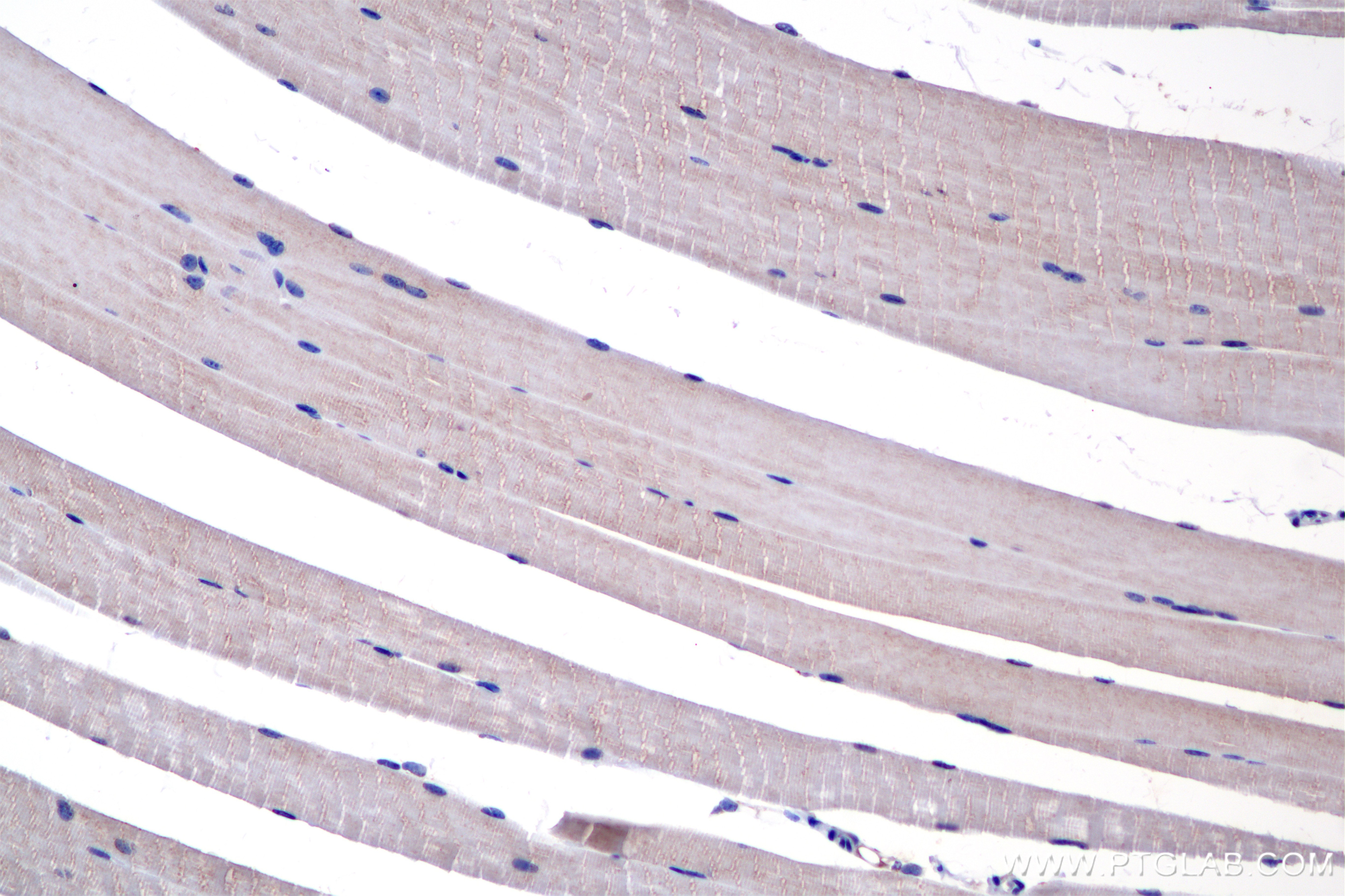 Immunohistochemical analysis of paraffin-embedded mouse skeletal muscle tissue slide using 85322-1-RR (MYH7 antibody) at dilution of 1:800 (under 20x lens). Heat mediated antigen retrieval with Tris-EDTA buffer (pH 9.0). Immunohistochemistry (IHC) staining of mouse skeletal muscle tissue using MYH7 Recombinant monoclonal antibody (85322-1-RR)