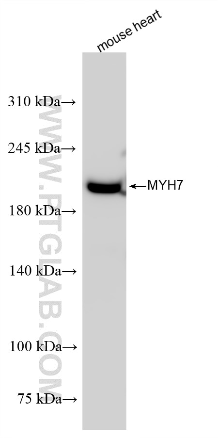 Western Blot (WB) analysis of mouse heart tissue using MYH7 Recombinant antibody (85322-1-RR)