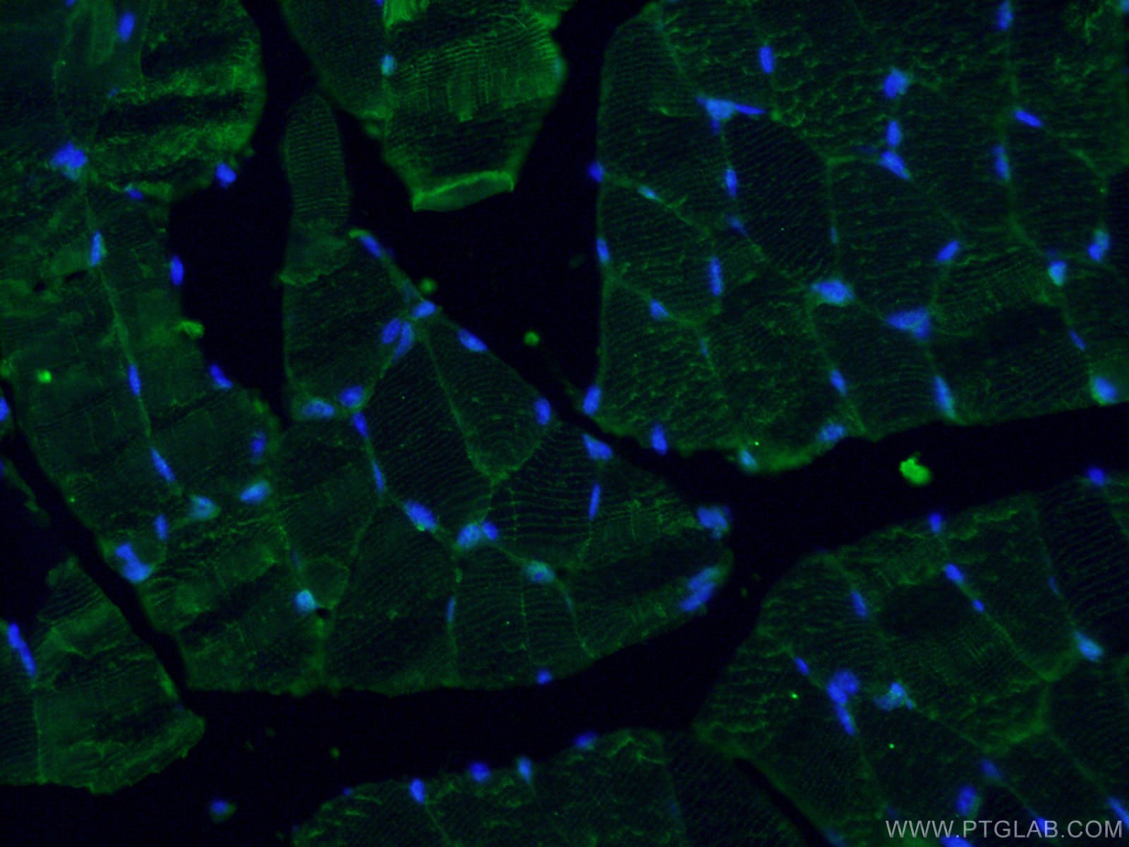 Immunofluorescence (IF) / fluorescent staining of mouse skeletal muscle tissue using MYH7-specific Polyclonal antibody (22280-1-AP)