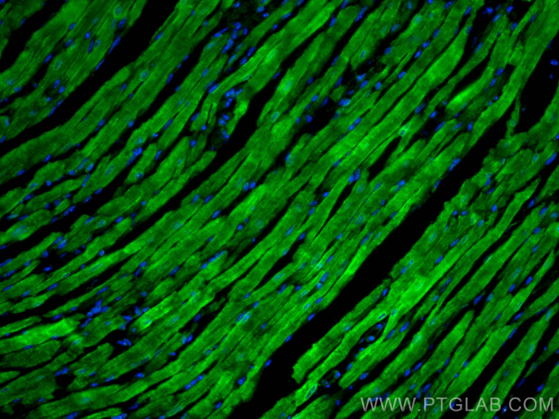 Immunofluorescence (IF) / fluorescent staining of mouse heart tissue using MYH7-specific Polyclonal antibody (22280-1-AP)