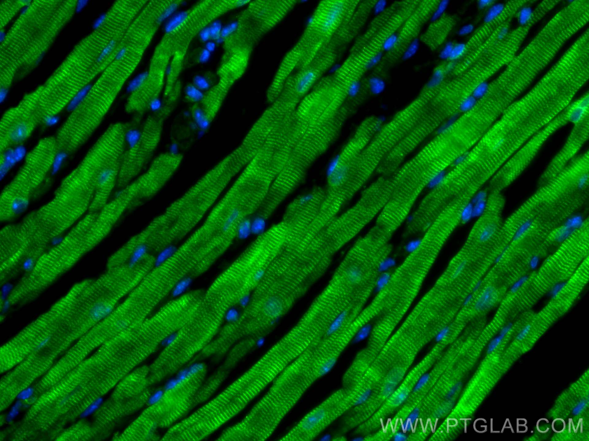 Immunofluorescence (IF) / fluorescent staining of mouse heart tissue using MYH7-specific Polyclonal antibody (22280-1-AP)